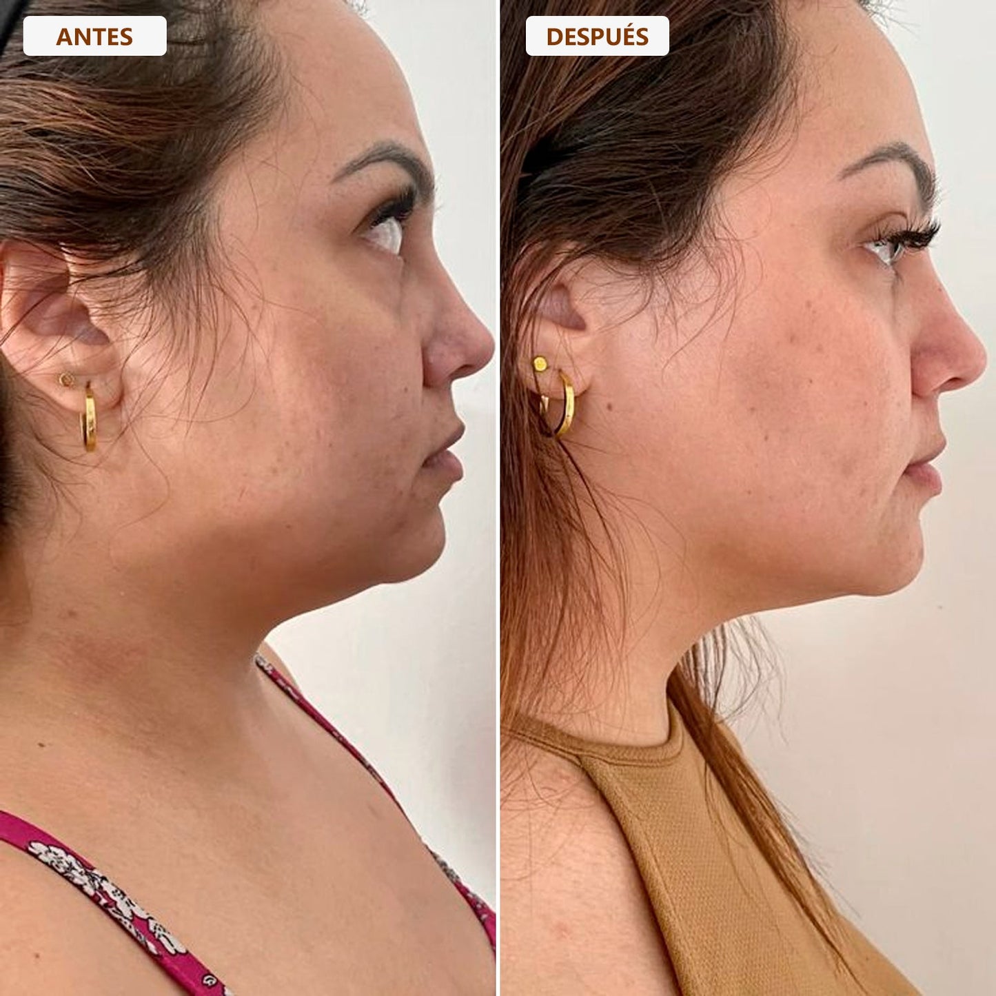 Cepillo drenaje linfático