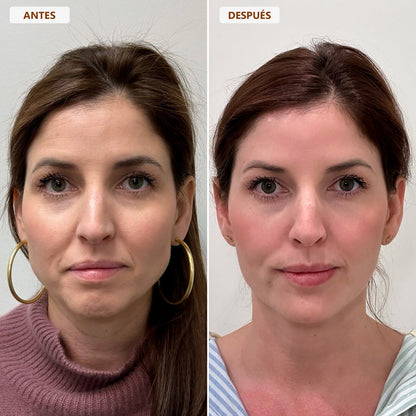 Cepillo drenaje linfático